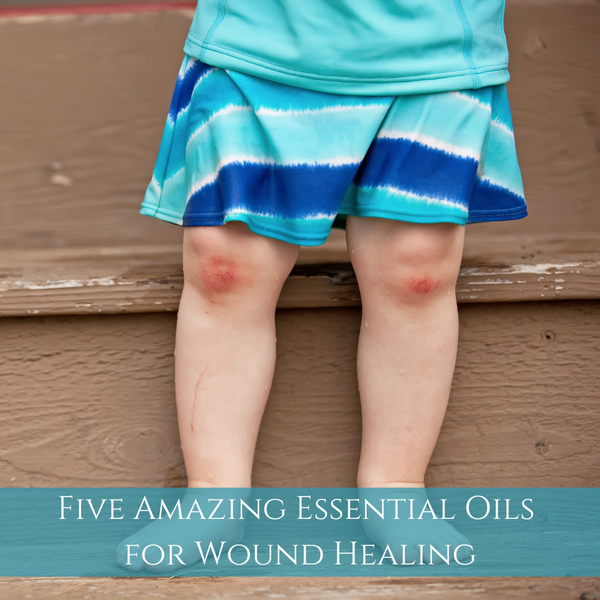 Five Amazing Essential Oils for Wound Healing