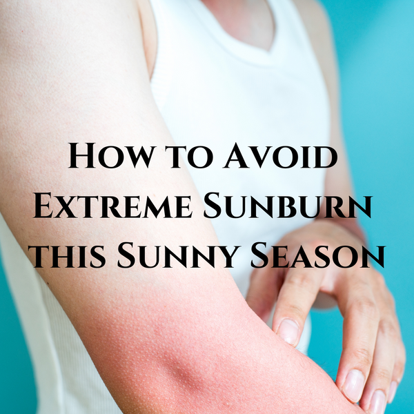 How to Avoid Extreme Sunburn this Sunny Season